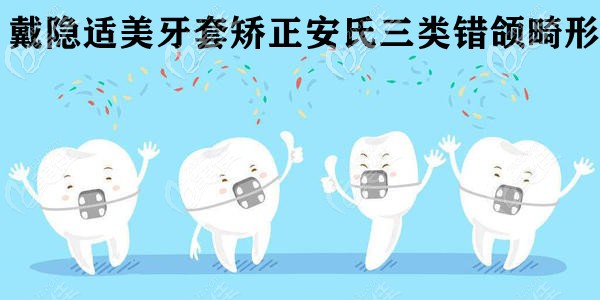 隱形矯正案例 隱形矯正案例