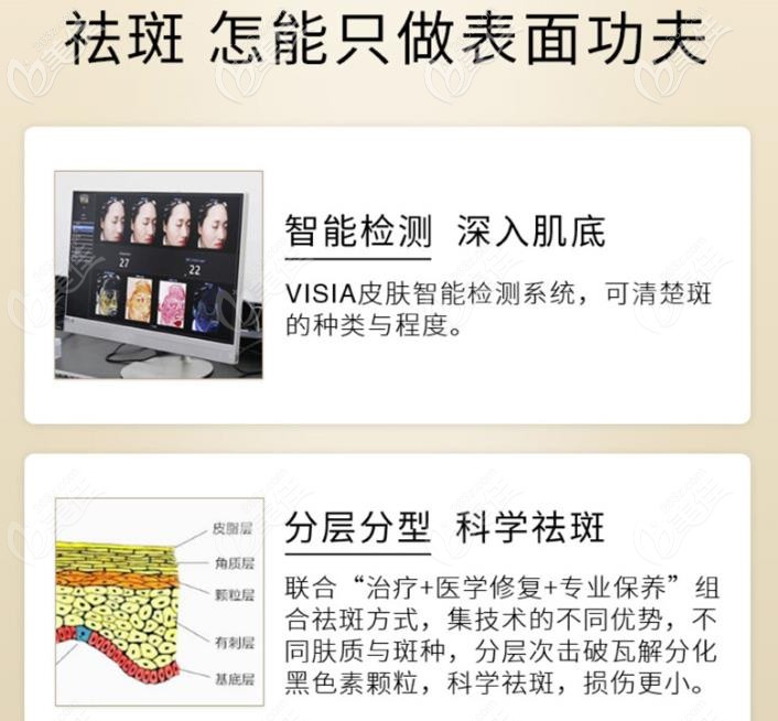 蕪湖名姝激光祛斑方法還是比較好的