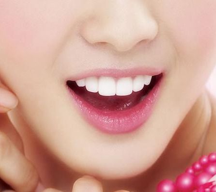 徐州美白牙齒美白