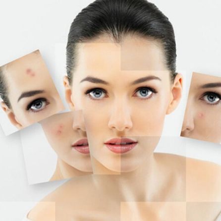 毛孔舒暢5次+中藥面膜5次+PDT治療5次僅需999！