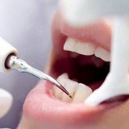 360℃牙周潔治洗牙