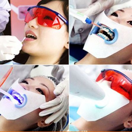 斯嘉麗牙齒冷光美白，牙齒美白，笑容才是女神般的美麗！