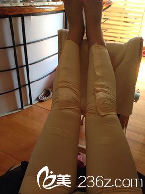 激光溶脂瘦大腿