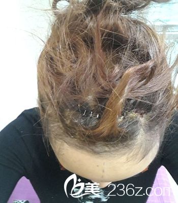 術(shù)后恢復(fù)