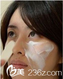 注射玻尿酸去皺