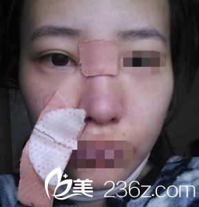 術(shù)后恢復(fù)