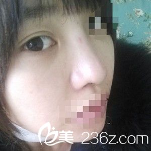 術(shù)后恢復(fù)