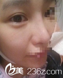 術(shù)后恢復(fù)