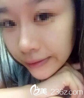 國內(nèi)微整形