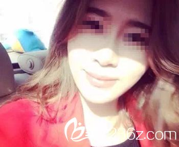 國內(nèi)微整形