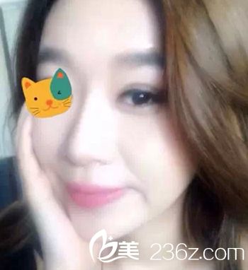 國內(nèi)微整形