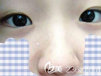 術(shù)后恢復(fù)