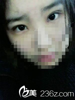 術(shù)后恢復(fù)