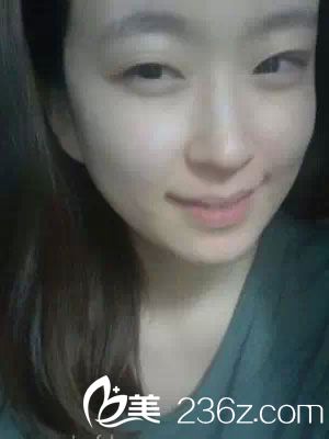 術(shù)后恢復(fù)