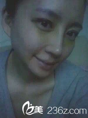 術(shù)后恢復(fù)