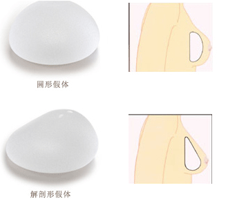 怎樣選擇適合自己的隆胸假體