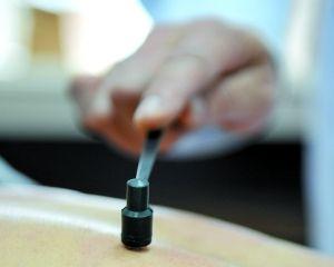 針灸美容輕松解決黃褐斑 讓你不再做“班長”