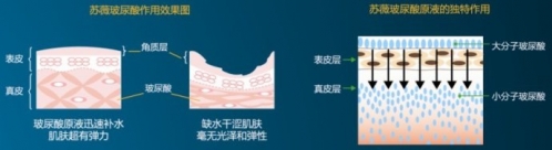 玻尿酸 讓女人告別枯萎