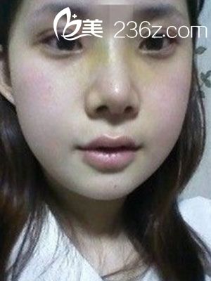 術(shù)后恢復(fù)