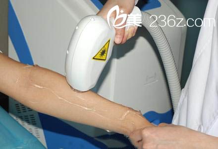 冰點(diǎn)脫毛手術(shù)時(shí)圖片