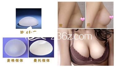 女性隆胸應(yīng)該選擇什么樣的假體？