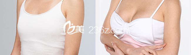 注射豐胸前后對(duì)比圖