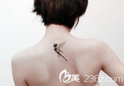 <!--<i data=20240703-sp></i>-->激光洗紋身需要多少錢