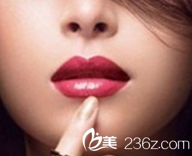 進(jìn)行唇部整形之前有哪些事項是需要知道的？