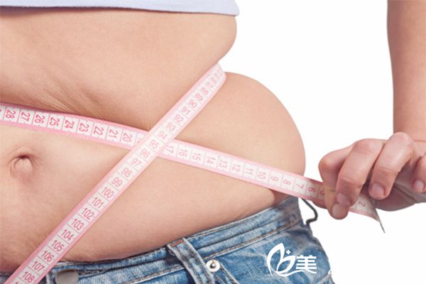 吸脂瘦腹部手術(shù)后會(huì)反彈嗎