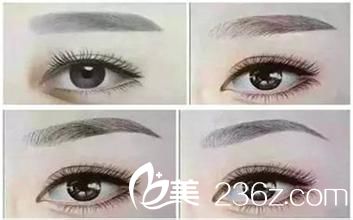 紋繡眉有哪些注意事項(xiàng)？