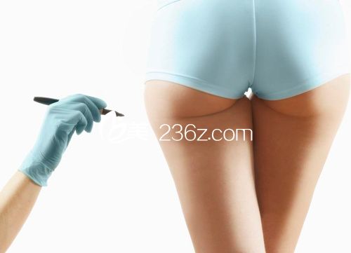 臀部吸脂