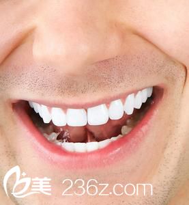 蛀牙牙疼怎么辦