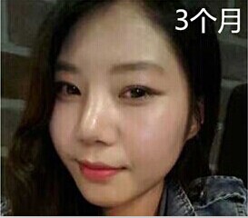 我的臉一直都很寬，讀書的時候同學給我取的外號是大臉貓。