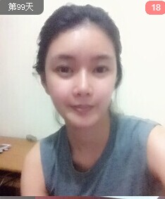 這是我手術(shù)前的樣子,以前的我沒有對外貌有特別的不滿,所以