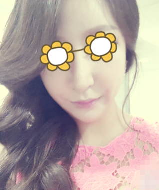 手術(shù)前，我一直是大長臉，朋友都說我的臉和我的上身一樣